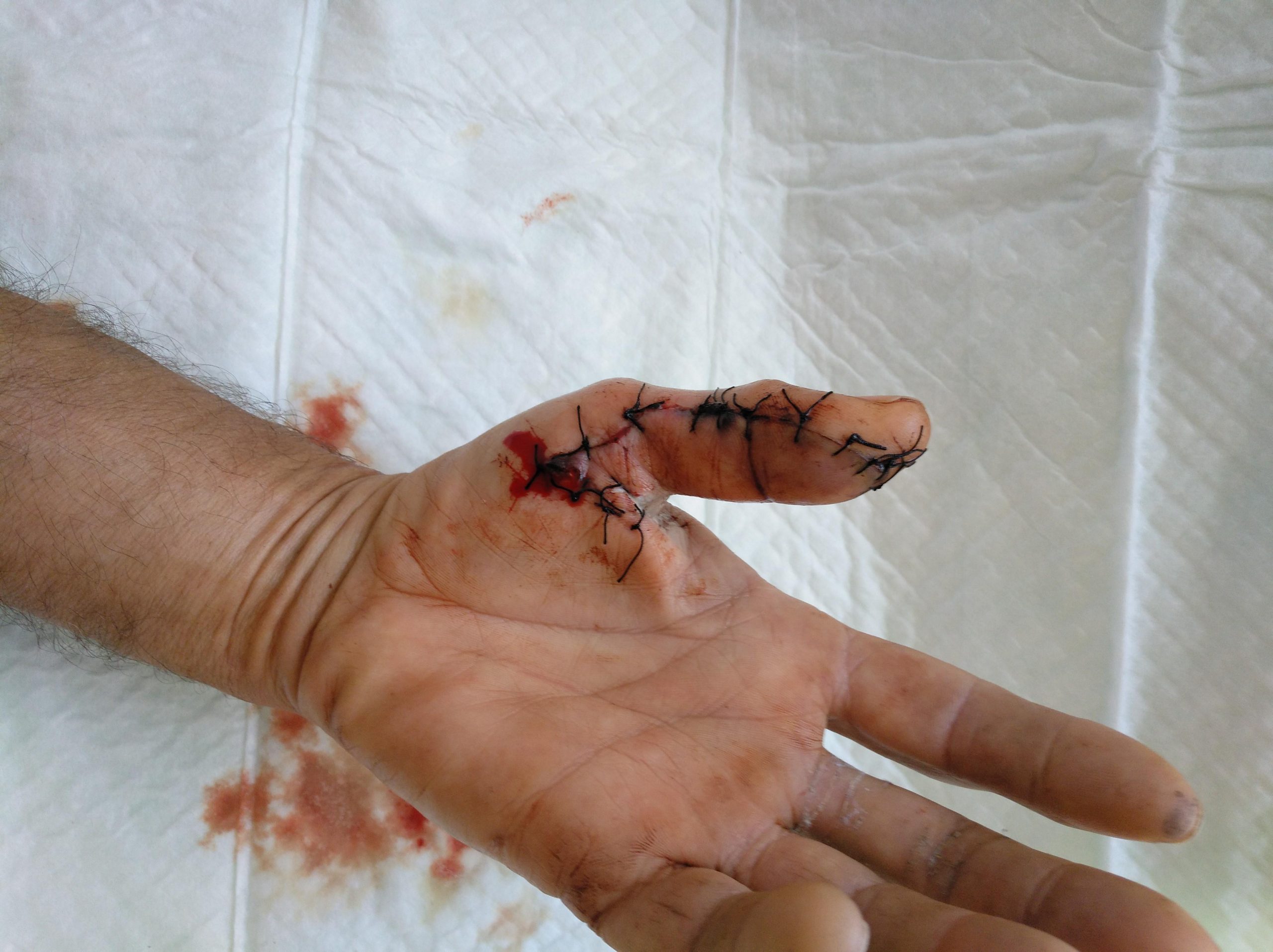 mano